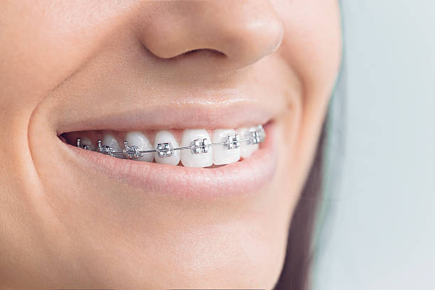 Best Invisalign and Clear Aligners  in Glens Falls North, NY